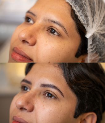 Micropigmentação fio a fio com naturalidade